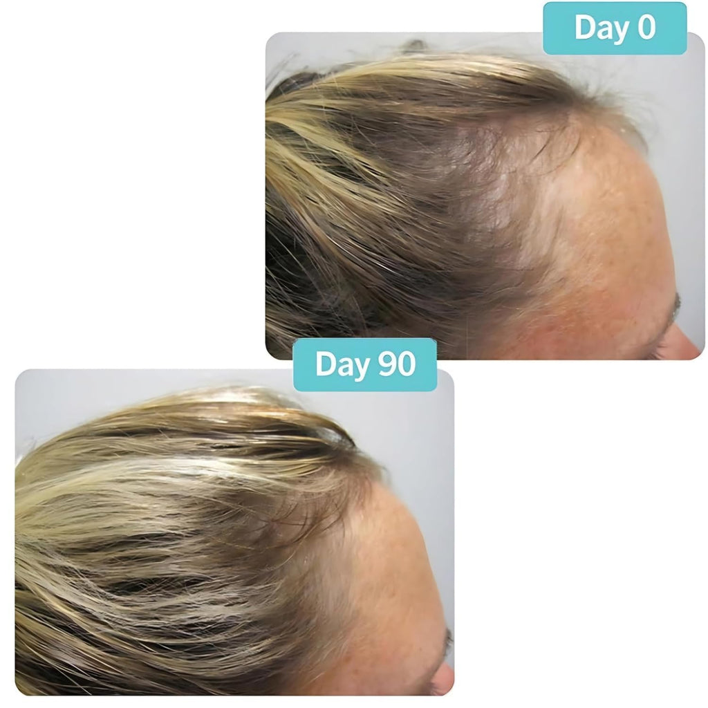 Hair Growth Supplement 180 Tablets U302