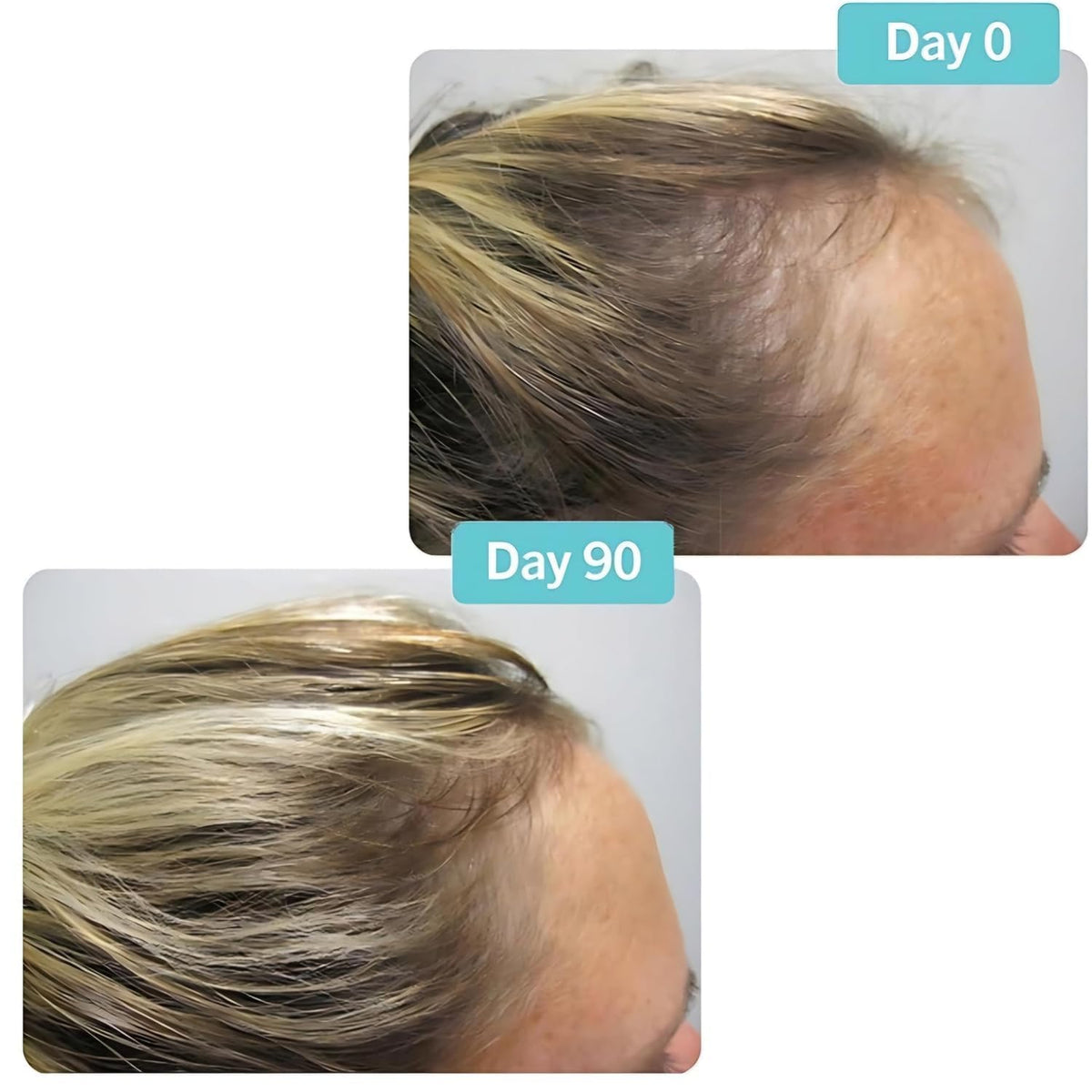 Hair Growth Supplement 180 Tablets U302